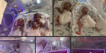 Unizik Lecturer Gives Birth to a Set of Seven Twins, Needs N19m To Offset Hospital Bill