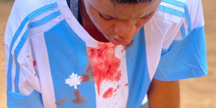 Man Abandons Daughter In Anambra Academy Batter Players, Arrests Ex Falcons